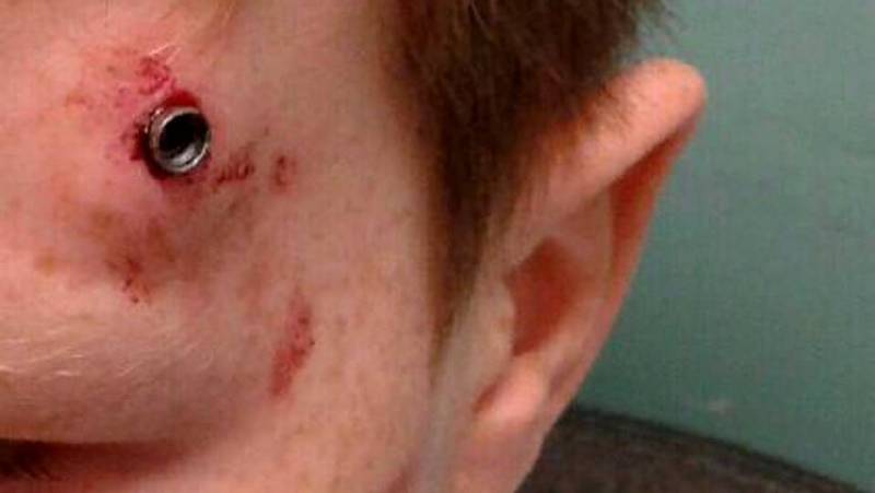 Devocional: Un disparo en la oscuridad