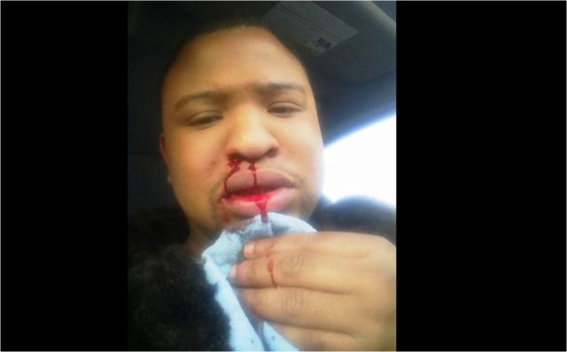 Ex-gay agredido por decir que Dios lo liberó de homosexualidad