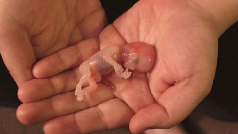 61 millones de abortos en Estados Unidos desde 1973